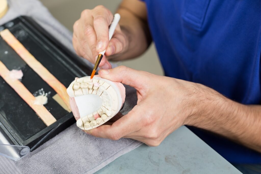 Family Dentist of Stuart | Dental Inlays and Onlays