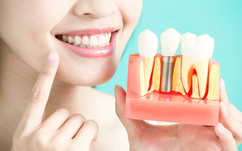 Family Dentist of Stuart | Red Flags: 7 Warning Signs Of Dental Implant Trouble