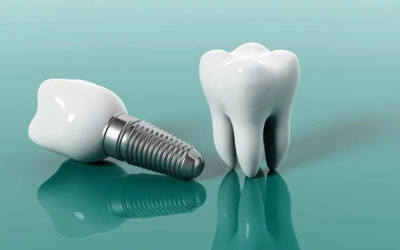 Family Dentist of Stuart | Your Day-By-Day Guide To Flawless Dental Implant Healing