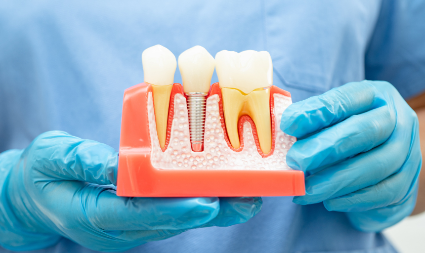 Family Dentist of Stuart | Root Canal Renaissance: Restoring Teeth, Renewing Smiles