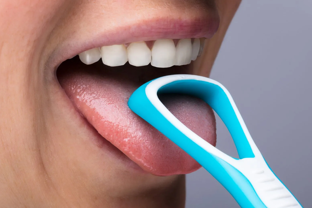 Family Dentist of Stuart | Tongue Scraping: the Forgotten Frontier of Dental Hygiene