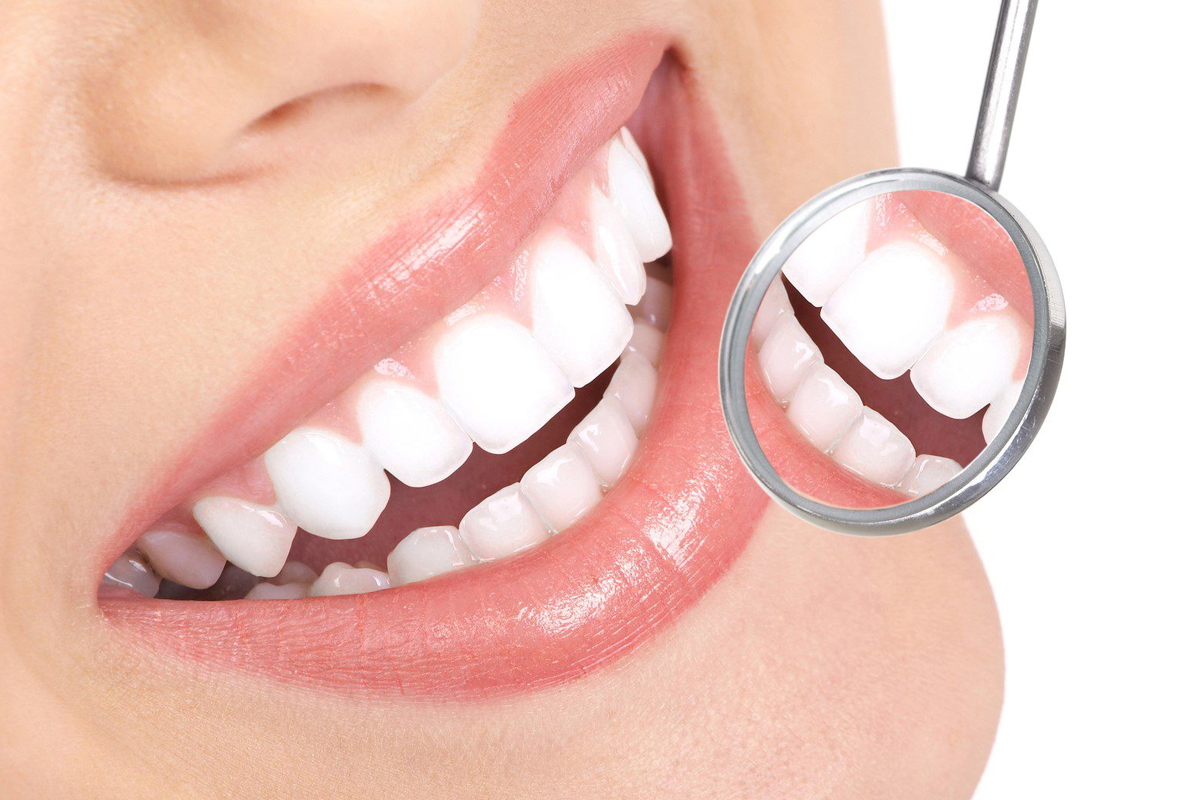 Family Dentist of Stuart | Unlock Your Best Smile With Dental Bonding
