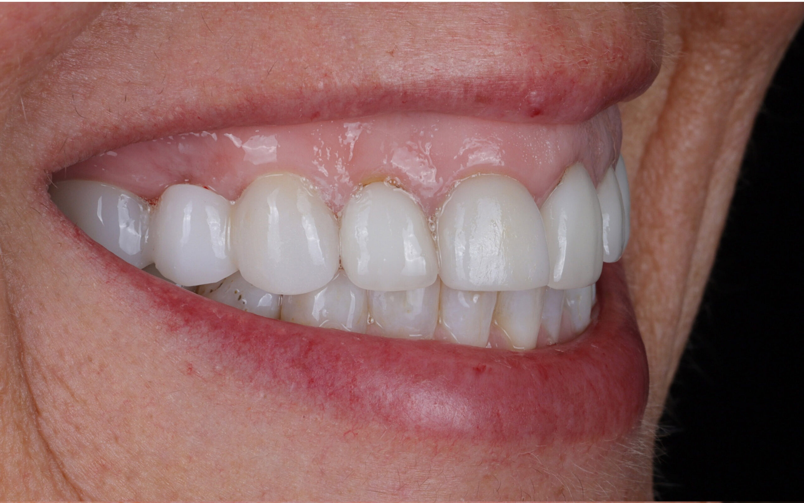 Family Dentist of Stuart | Smile Gallery