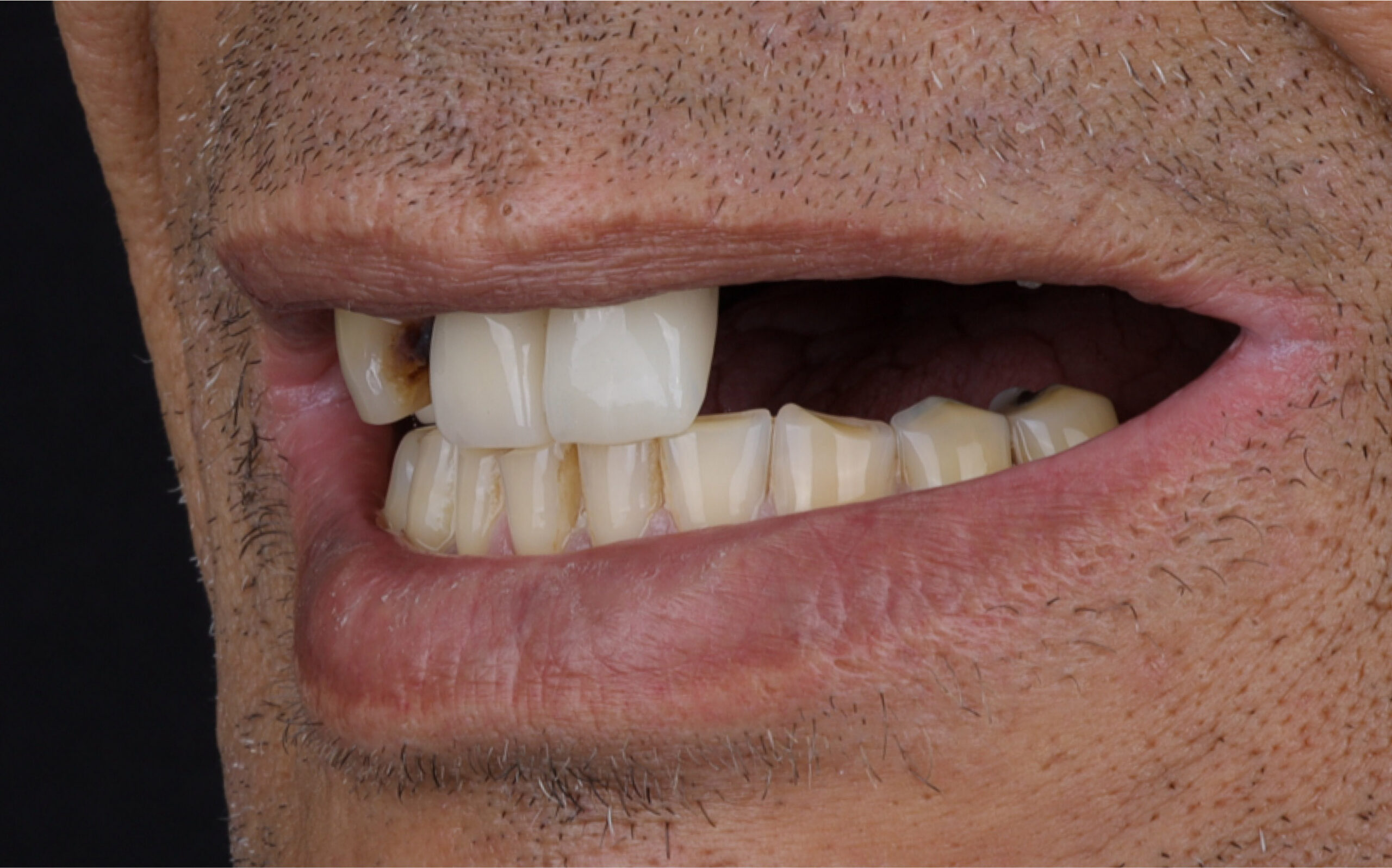 Family Dentist of Stuart | Smile Gallery