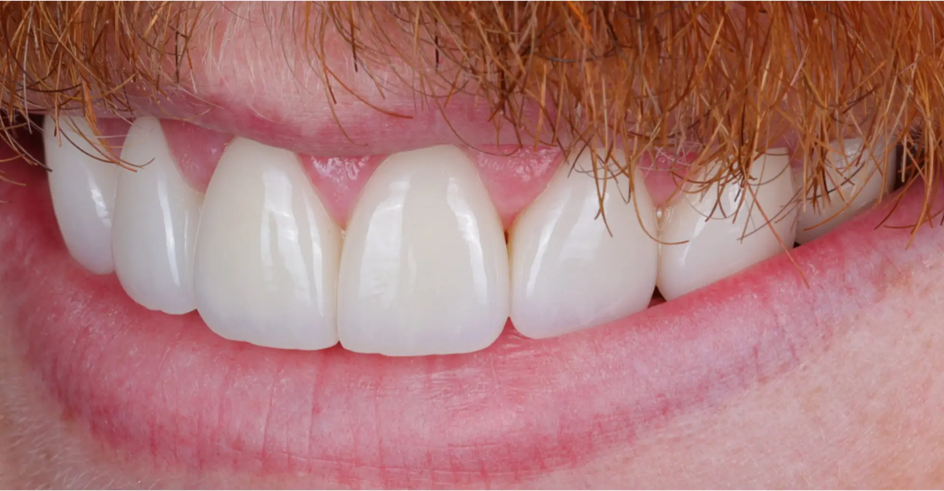 Family Dentist of Stuart | Smile Gallery