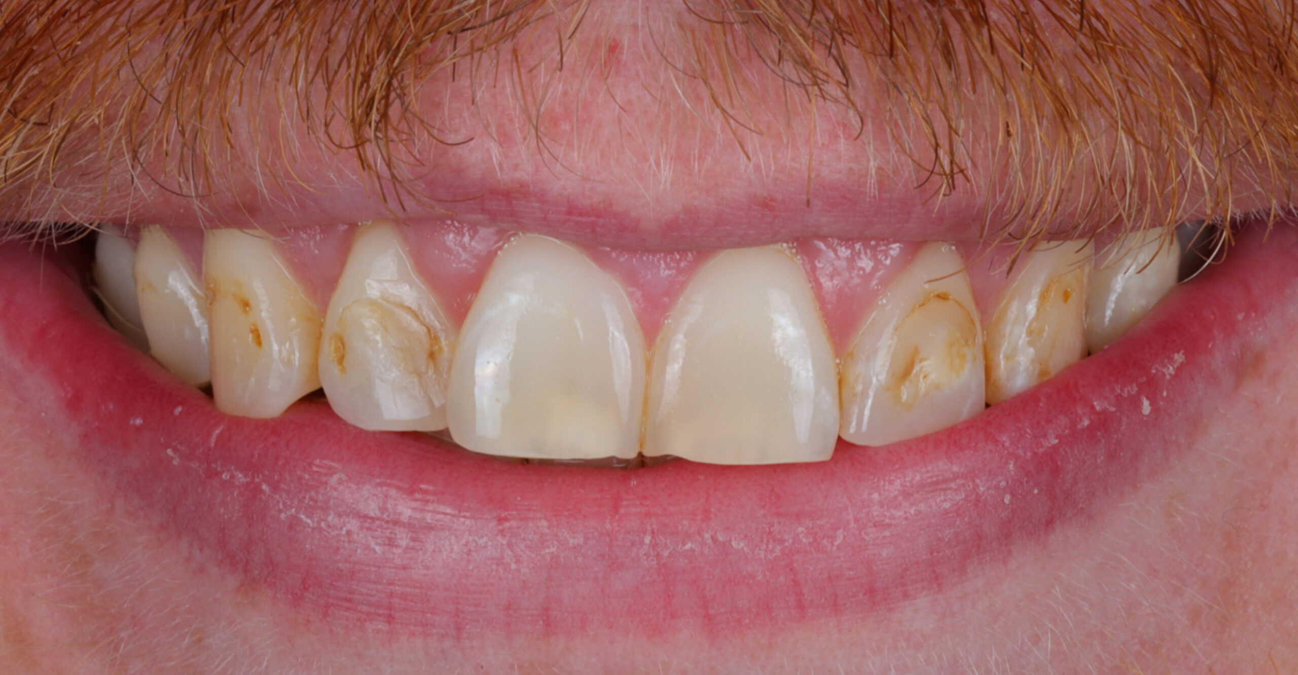 Family Dentist of Stuart | Smile Gallery