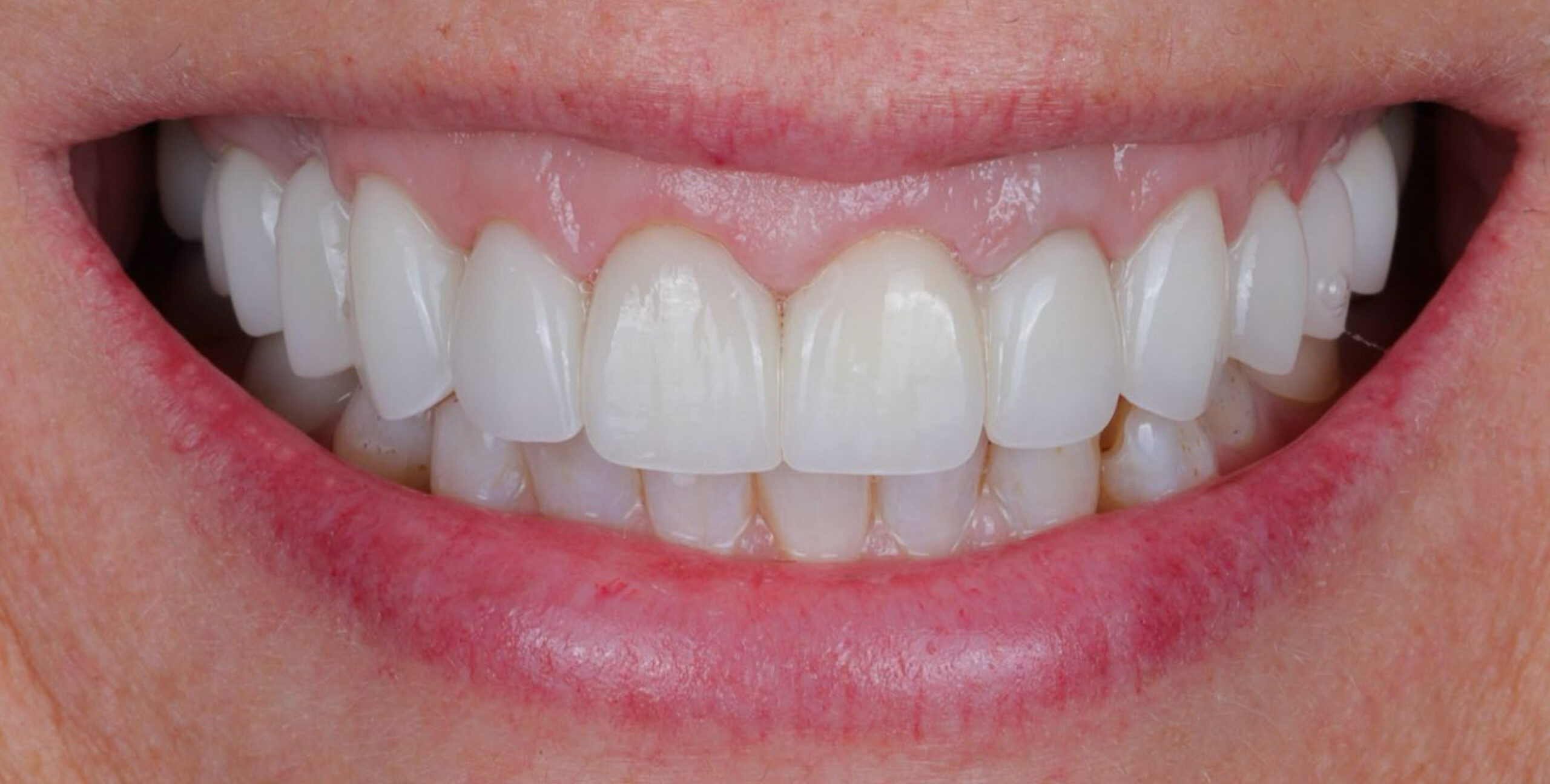 Family Dentist of Stuart | Smile Gallery