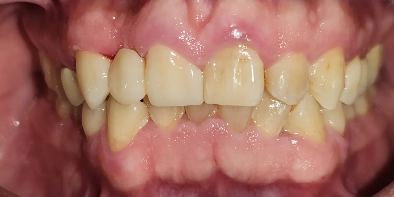 Family Dentist of Stuart | Smile Gallery