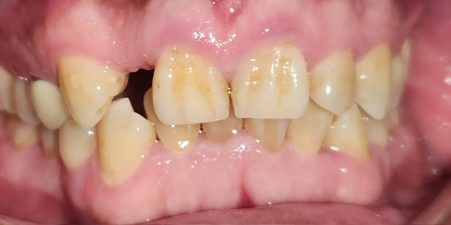 Family Dentist of Stuart | Smile Gallery
