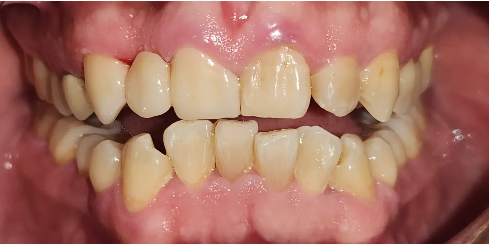 Family Dentist of Stuart | Smile Gallery
