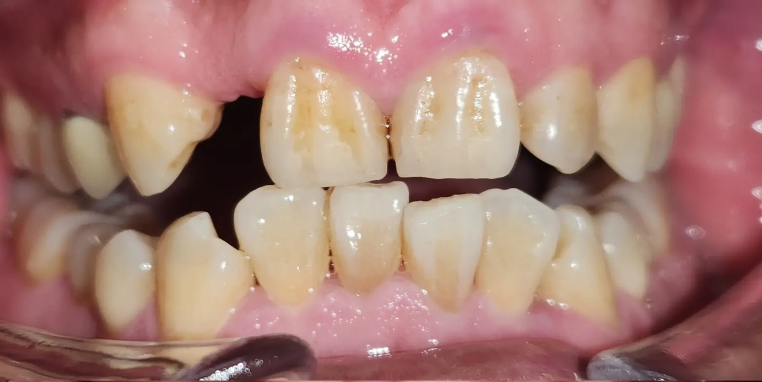 Family Dentist of Stuart | Smile Gallery