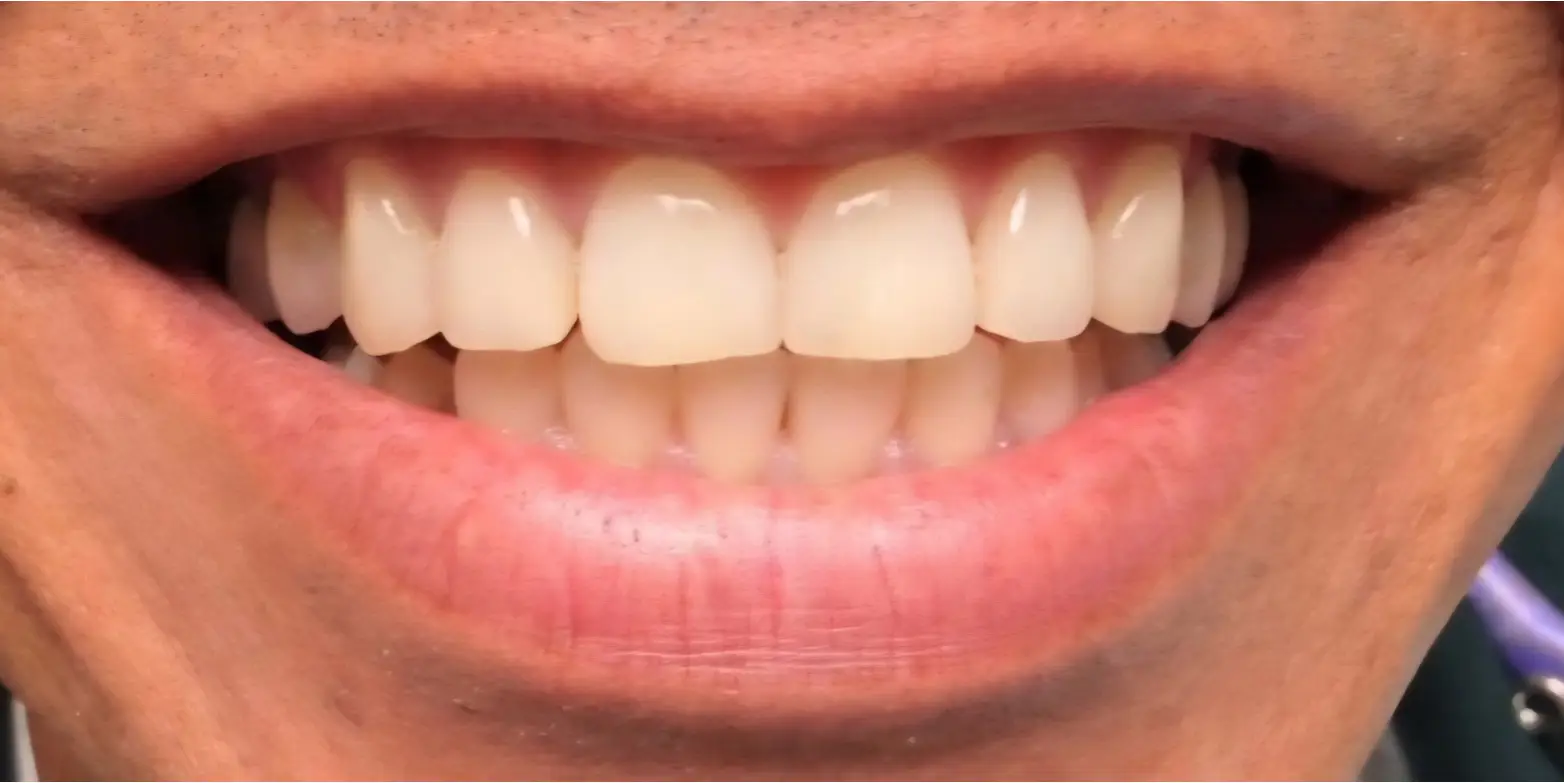 Family Dentist of Stuart | Smile Gallery