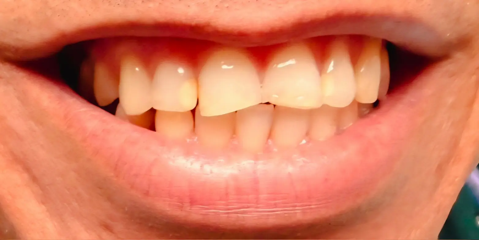 Family Dentist of Stuart | Smile Gallery