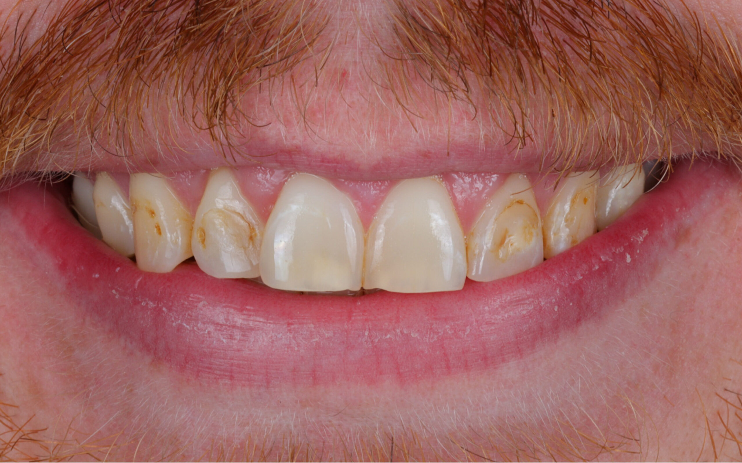 Family Dentist of Stuart | Smile Gallery