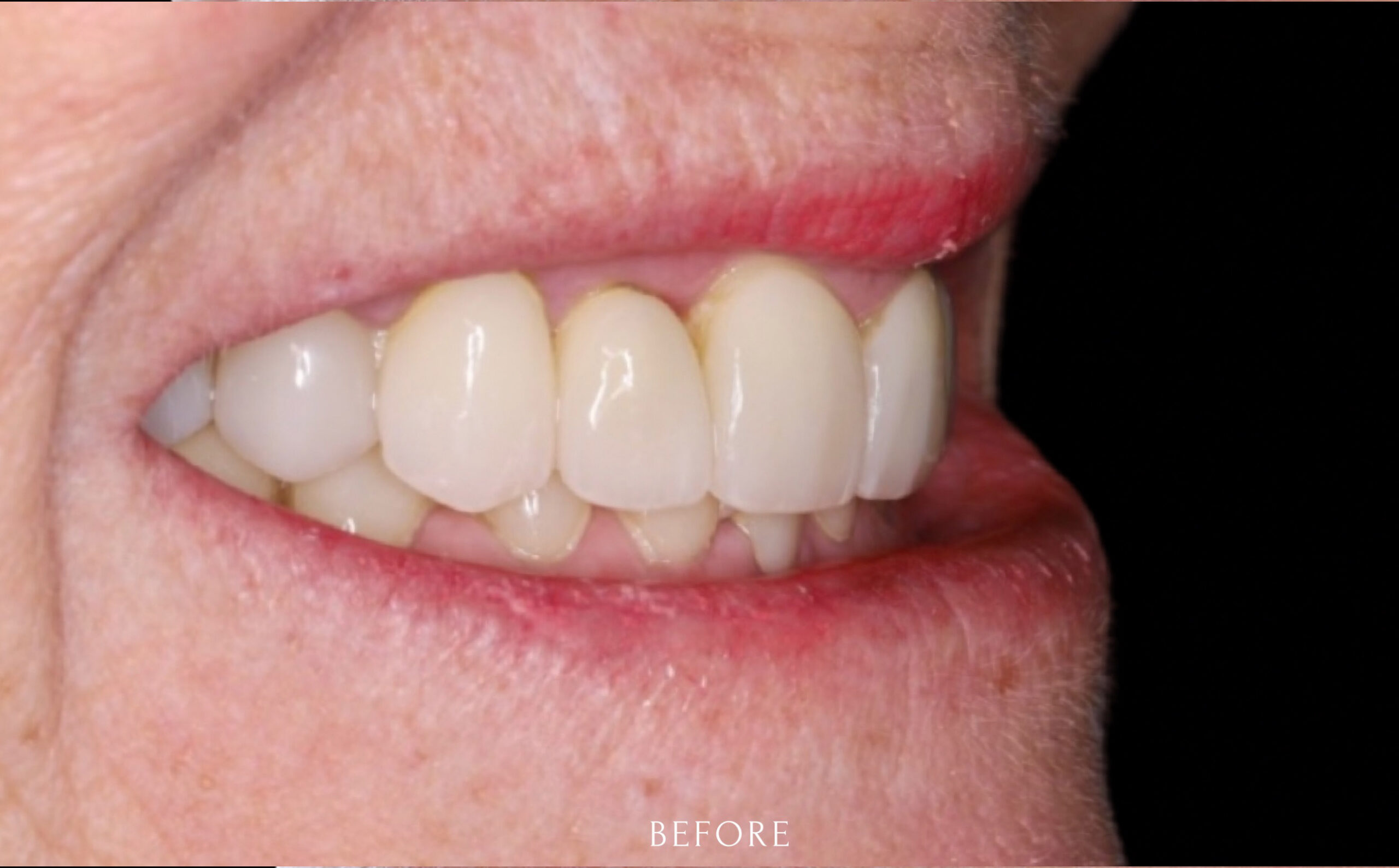 Family Dentist of Stuart | Smile Gallery