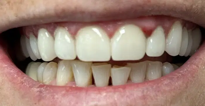 Family Dentist of Stuart | Smile Gallery