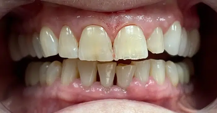 Family Dentist of Stuart | Smile Gallery