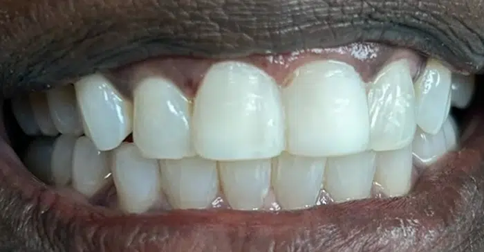 Family Dentist of Stuart | Smile Gallery