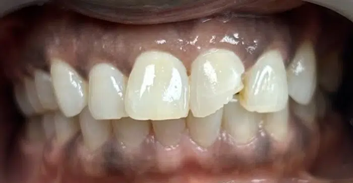 Family Dentist of Stuart | Smile Gallery