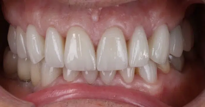 Family Dentist of Stuart | Smile Gallery