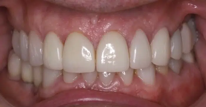Family Dentist of Stuart | Smile Gallery