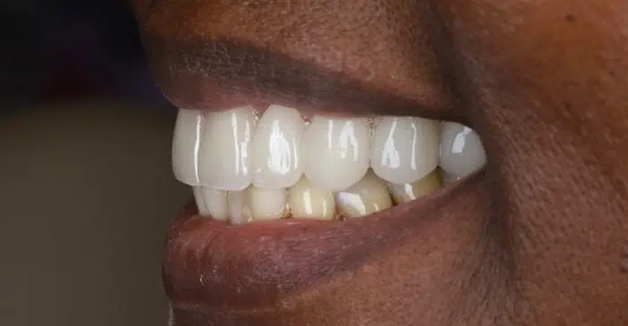 Family Dentist of Stuart | Smile Gallery