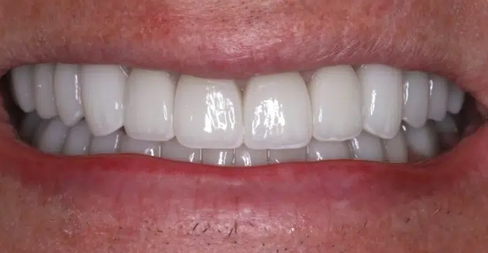 Family Dentist of Stuart | Smile Gallery