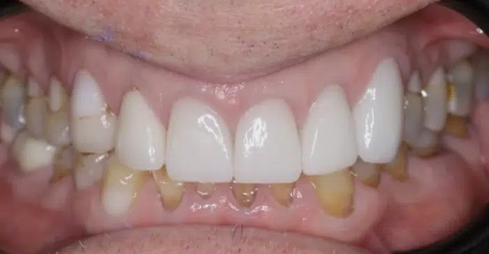Family Dentist of Stuart | Smile Gallery