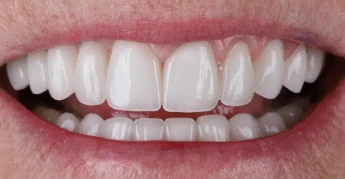Family Dentist of Stuart | Smile Gallery