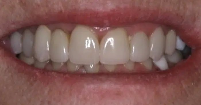 Family Dentist of Stuart | Smile Gallery