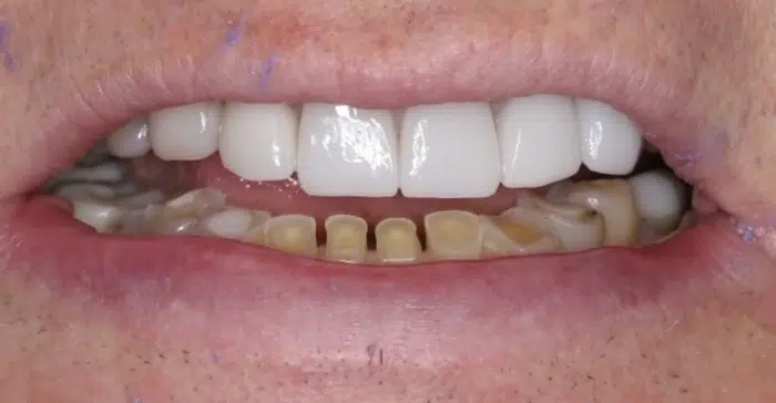 Family Dentist of Stuart | Smile Gallery