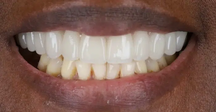Family Dentist of Stuart | Smile Gallery