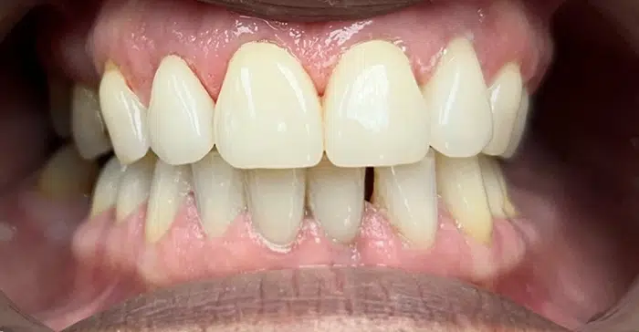 Family Dentist of Stuart | Smile Gallery