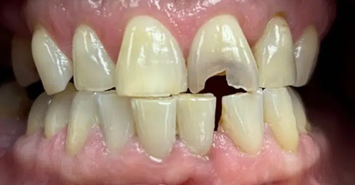 Family Dentist of Stuart | Smile Gallery