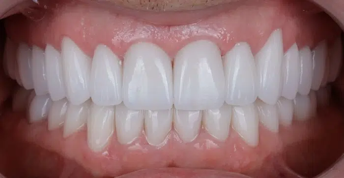Family Dentist of Stuart | Smile Gallery