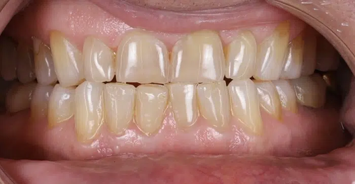 Family Dentist of Stuart | Smile Gallery