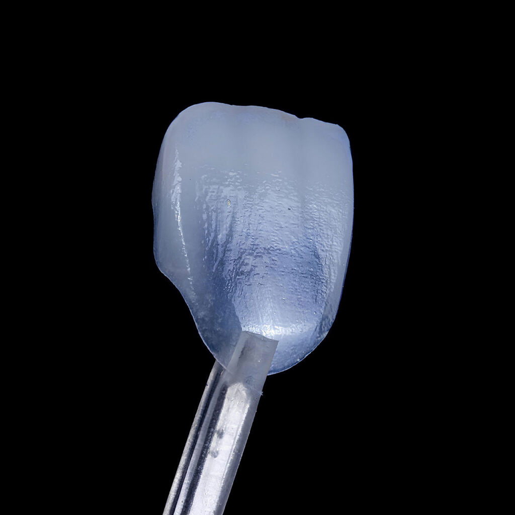 Dental Veneers in Stuart, FL: A Natural-Looking Way to Refine Your Smile